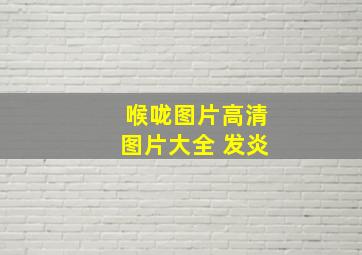 喉咙图片高清图片大全 发炎